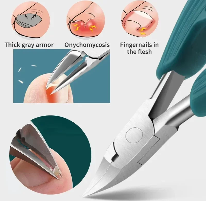 Kleštičky na zarostlé a silné nehty | pedikúra, péče o nehty