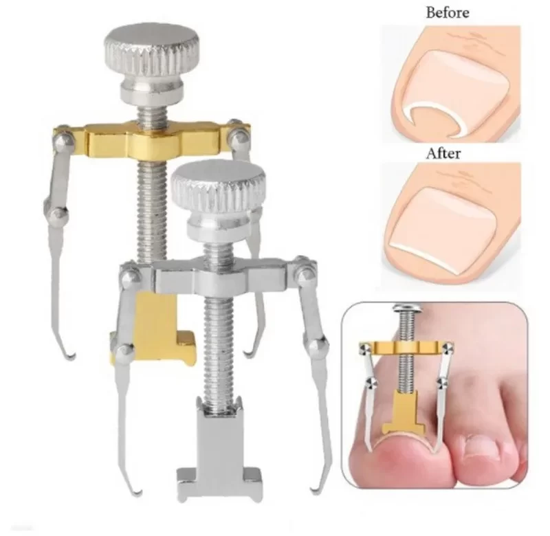 Nástroj pro zarostlý nehet | ošetření nehtů